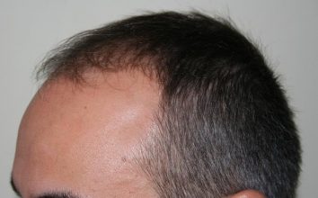 dr-keser-two-operations (4)