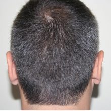 dr-keser-two-operations (5)