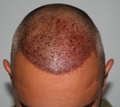 dr-keser-two-operations (7)