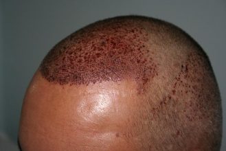 dr-keser-two-operations (8)