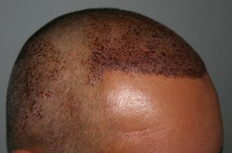 dr-keser-two-operations (9)