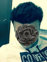 dr-kul-hair-transplant-results (5)