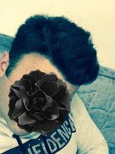 dr-kul-hair-transplant-results (6)