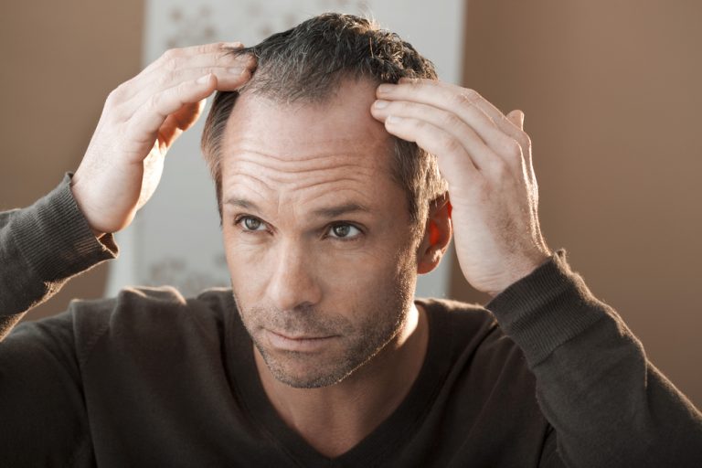 WHAT IS HAIR CLONING? Hair Transplant in Turkey