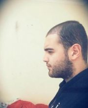 hair-restoration (5)