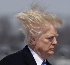 trump-hair-transplant