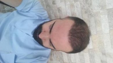 dr-kul-3500-grafts (19)