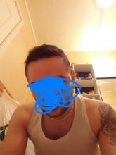 dr-kul-hair-transplant (19)