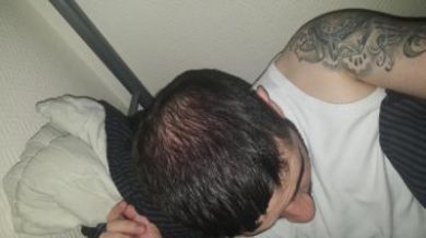 dr-kul-hair-transplant (35)