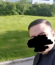 dr-kul-hair-transplant (38)