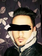 dr-kul-hair-transplant (39)