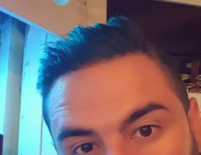 dr-kul-hair-transplant (4)