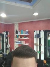 beard-hair-transplant (1)