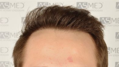 koray-erdogan-results (1)