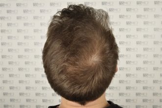 koray-erdogan-results (10)