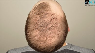 koray-erdogan-results (11)