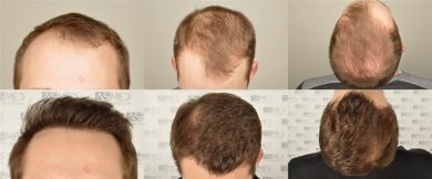 koray-erdogan-results (13)