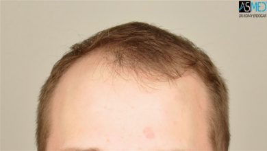 koray-erdogan-results (14)