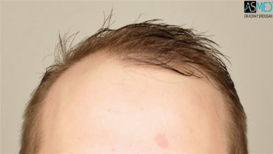 koray-erdogan-results (15)