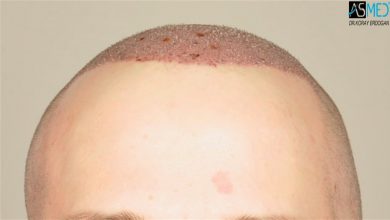 koray-erdogan-results (16)