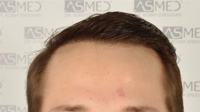 koray-erdogan-results (2)