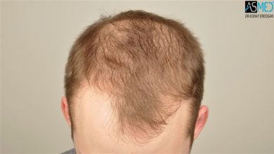 koray-erdogan-results (3)