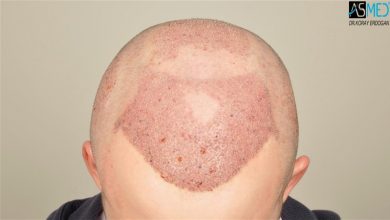 koray-erdogan-results (5)