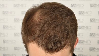 koray-erdogan-results (6)