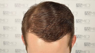 koray-erdogan-results (7)