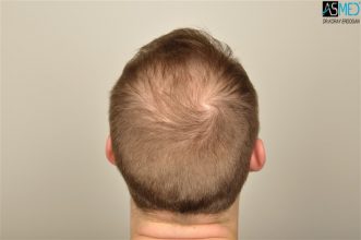 koray-erdogan-results (8)