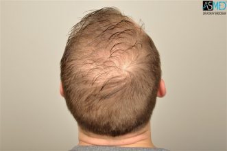 koray-erdogan-results (9)