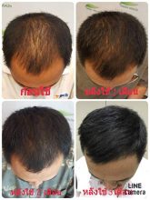 hair-care-product (1)