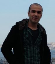 before-hair-transplant