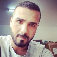 serkan-aygin-hair-transplant (1)