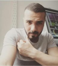 serkan-aygin-hair-transplant (2)