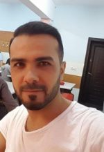 serkan-aygin-hair-transplant (3)