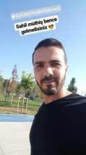 serkan-aygin-hair-transplant (4)