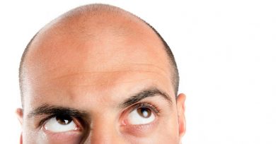 why-people-choose-turkey-for-hair-transplant