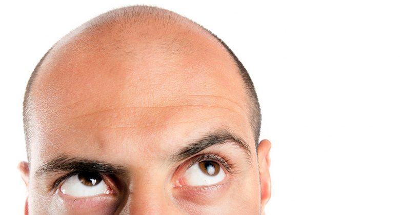 why-people-choose-turkey-for-hair-transplant