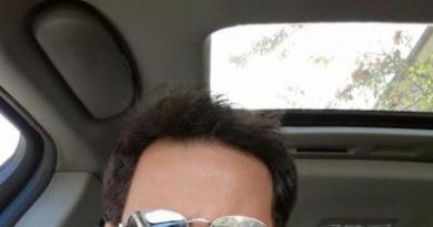 dr-kul-hair-transplant (1)