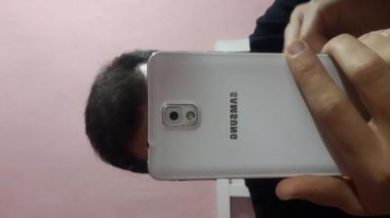 3250-grafts-hair-transplant-results (20)