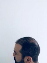 emrah-cinik-hair-transplant-center (1)