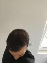 emrah-cinik-hair-transplant-center (17)