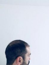 emrah-cinik-hair-transplant-center (2)