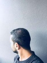 emrah-cinik-hair-transplant-center (4)