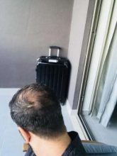 emrah-cinik-hair-transplant-center (5)