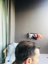 emrah-cinik-hair-transplant-center (6)