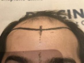 emrah-cinik-hair-transplant-center (7)