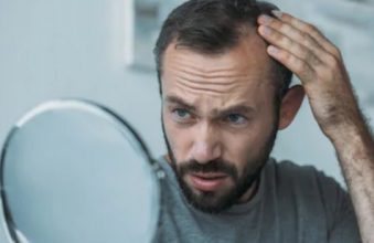 hair-transplant-in-turkey