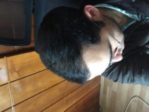 3650-grafts-hair-transplant (14)